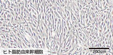 ヒト脂肪細胞